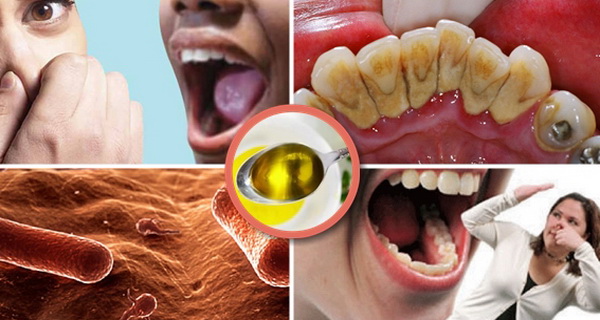 Ezzel a módszerrel elpusztíthatjuk a szájüregben lévő baktériumokat, megszünteti a rossz leheletet és a fogszuvasodást is elkerülhetjük!