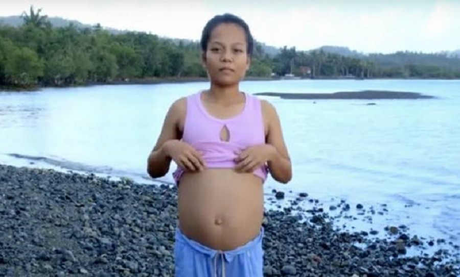 Hajmeresztő történet: Egy haltól lett terhes a 17 éves lány!