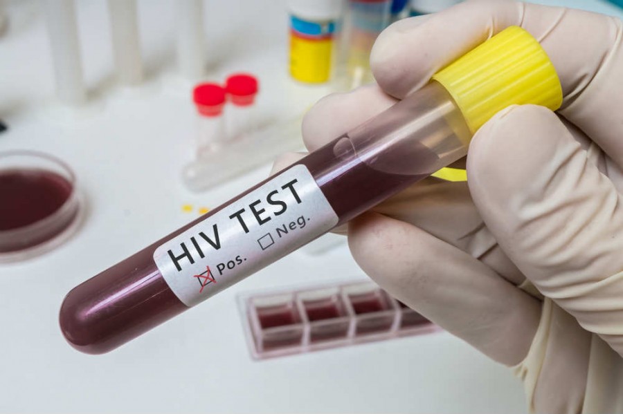 Több ezer HIV-fertőzött van már Magyarországon
