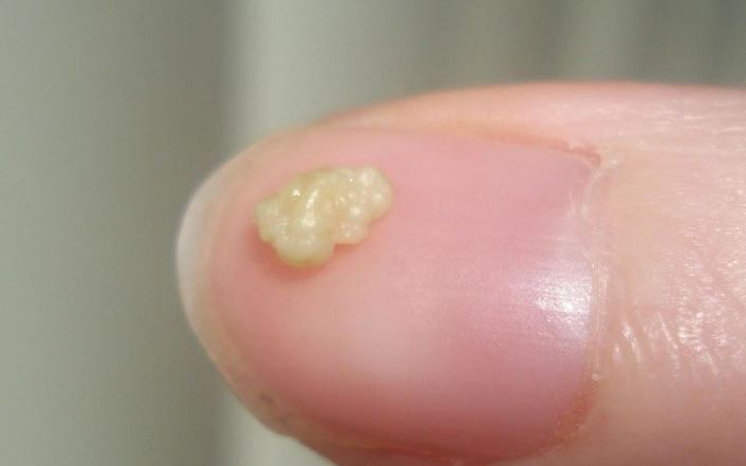 90%-ban ez okozza a rossz szájszagot