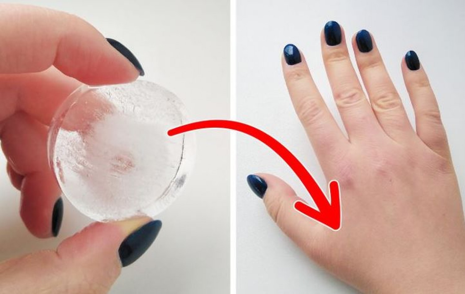 Így tudod blokkolni a fájdalmat egy jégkockával