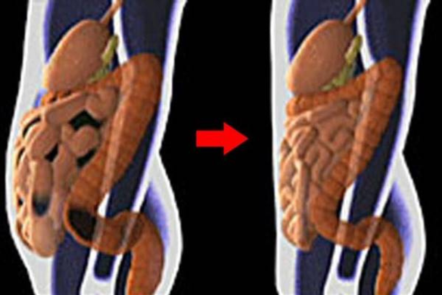 Egyszerű de annál hatékonyabb tisztítókúra