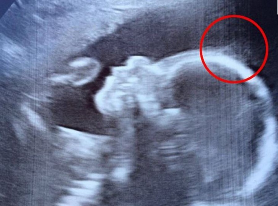 Az orvos furcsa dolgot észlelt az ultrahangos képen