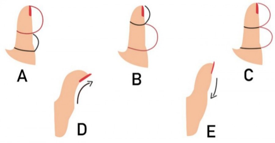 A hüvelykujjad formája rendkívül sok mindent elárul a személyiségedről